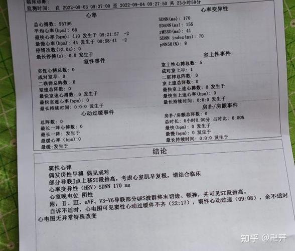 早搏能治愈吗